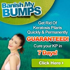 Honest Banish My Bumps Review