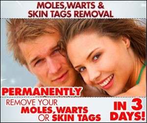 Honest Moles Warts Removal Review