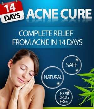 Honest Overnight Acne Cures Review